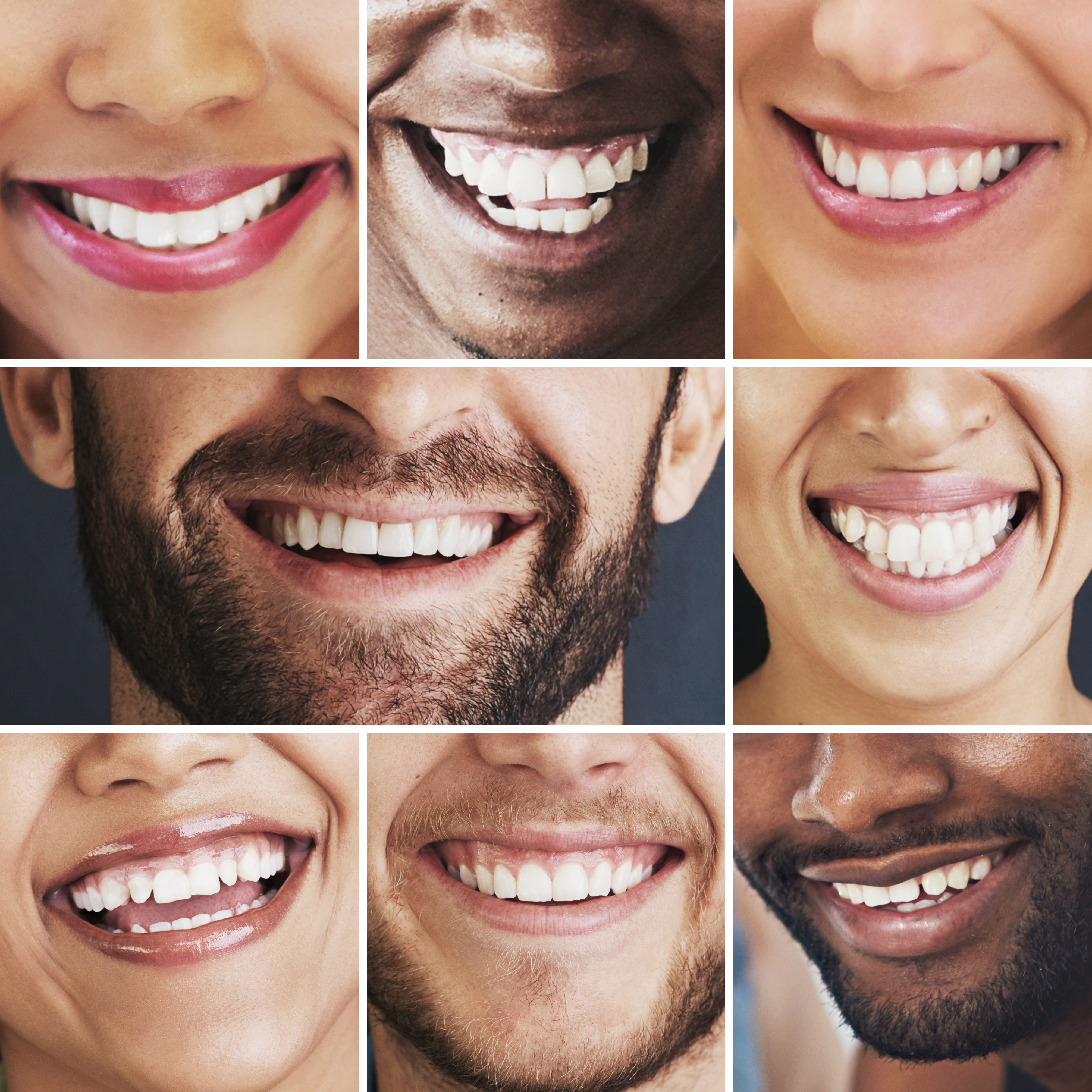 The Art & Science of a Smile Makeover: What Every Patient Should Know